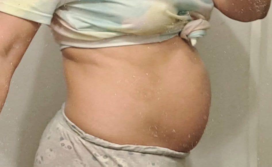 Abdominal wall in profile after three months of hypopressive rehabilitation